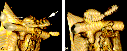 Fig 2.