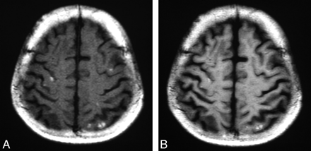 Fig 1.