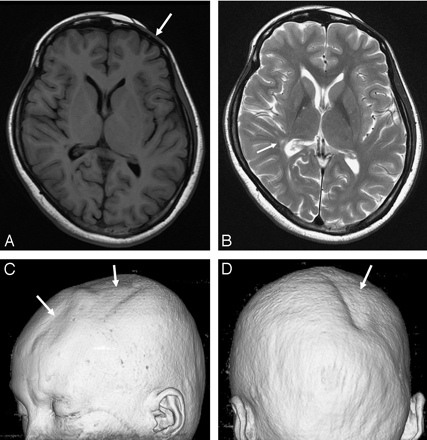 Fig 1.