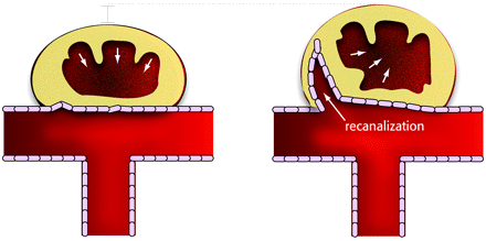 Fig 8.