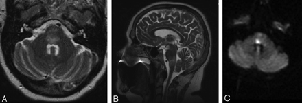 Fig 2.