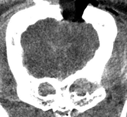 Fig 2.