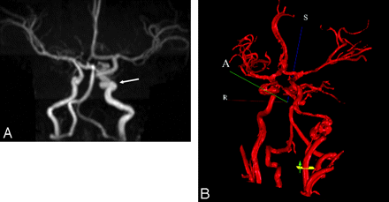 Fig 4.