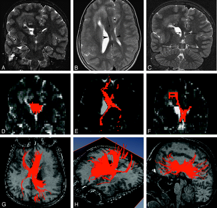 Fig 3.