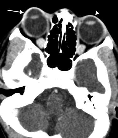 Fig 1.
