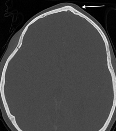 Fig 3.
