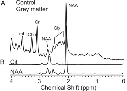 Fig 4.