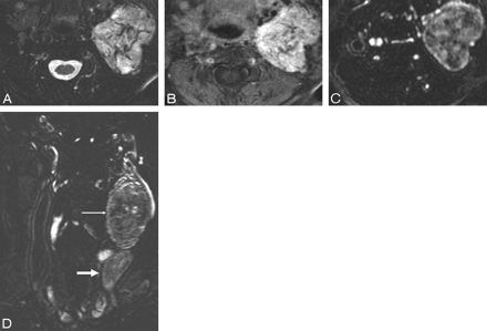 Fig 2.