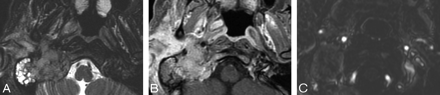 Fig 3.