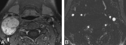 Fig 4.