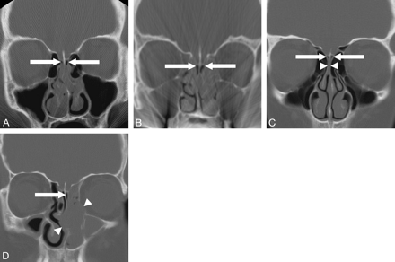 Fig 1.