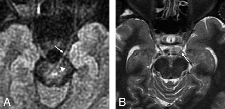 Fig 1.