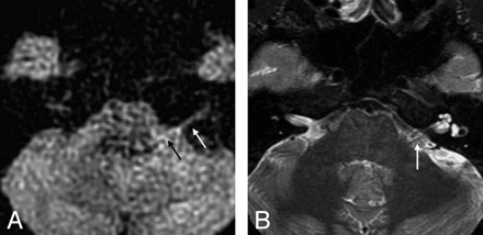 Fig 3.