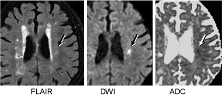   Fig 1. 