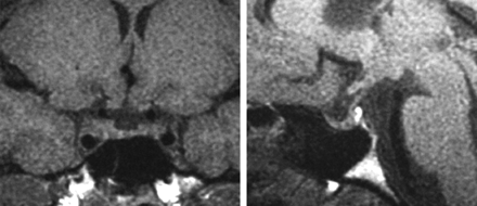 Fig 2.