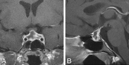 Fig 3.