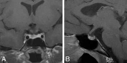 Fig 4.