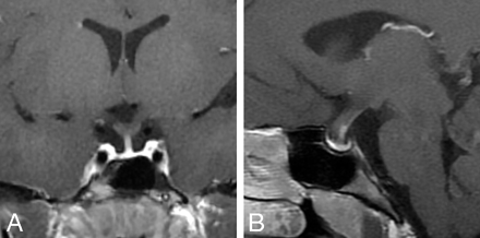 Fig 5.