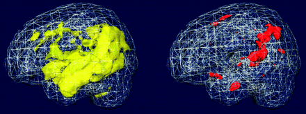 Fig 2.