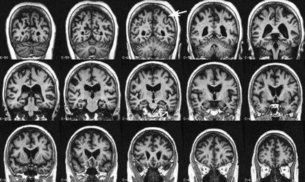 Fig 3.
