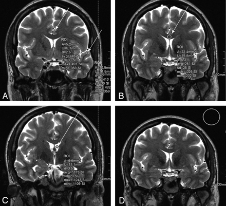 Fig 2.