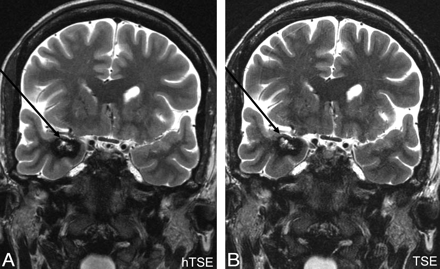 Fig 6.