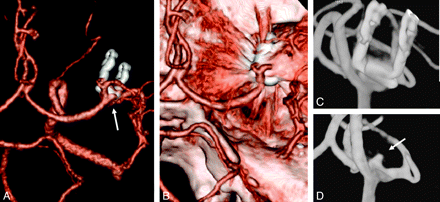Fig 2.