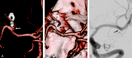 Fig 3.