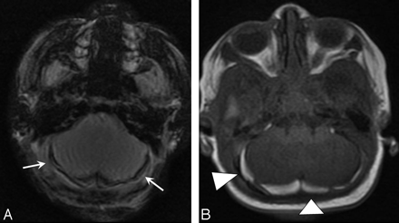 Fig 1.