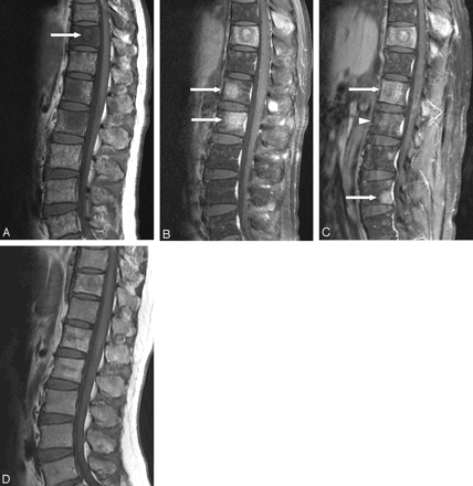 Fig 3.