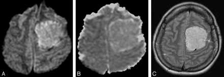 Fig 2.