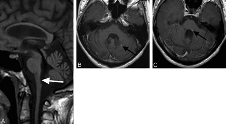 Fig 3.