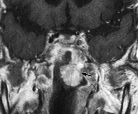 Fig 2.