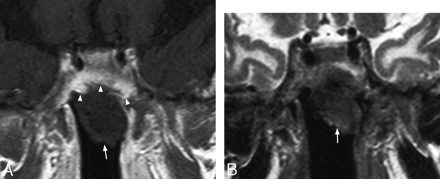 Fig 5.