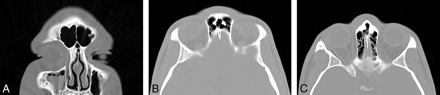 Fig 3.