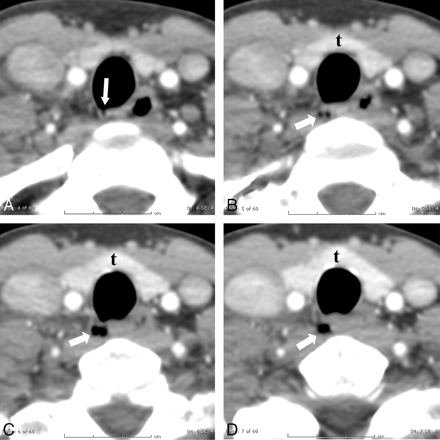 Fig 3.