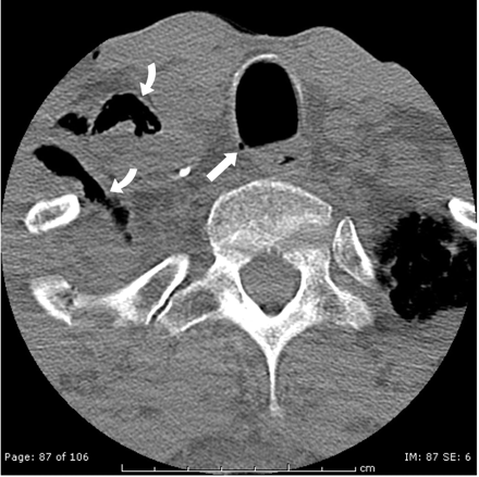 Fig 4.