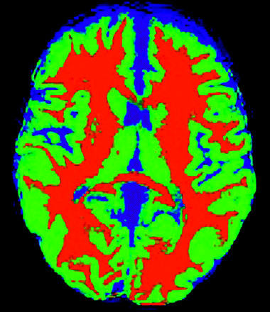 Fig 1.