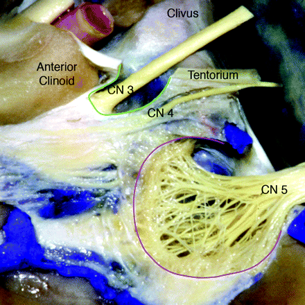 Fig 3.