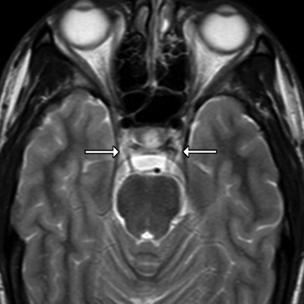 Fig 4.
