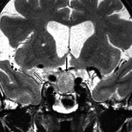 Fig 7.