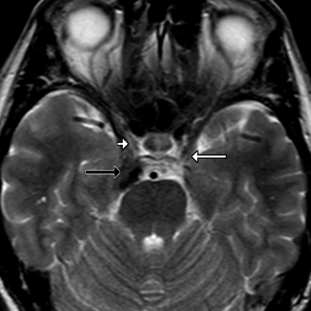 Fig 8.