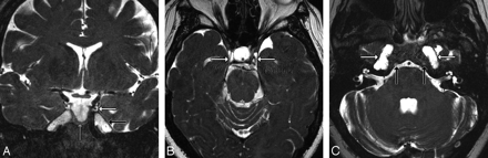 Fig 9.