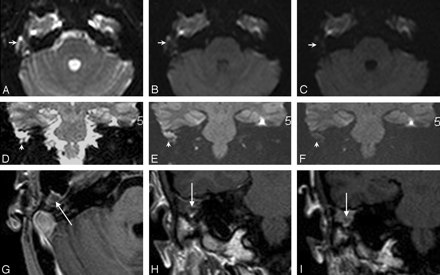 Fig 2.