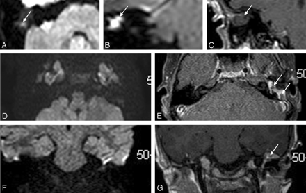 Fig 3.