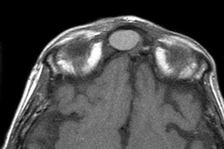 Fig 2.