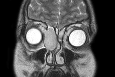 Fig 6.