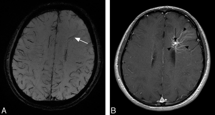   Fig 1. 