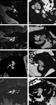 Fig 3.