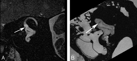 Fig 4.